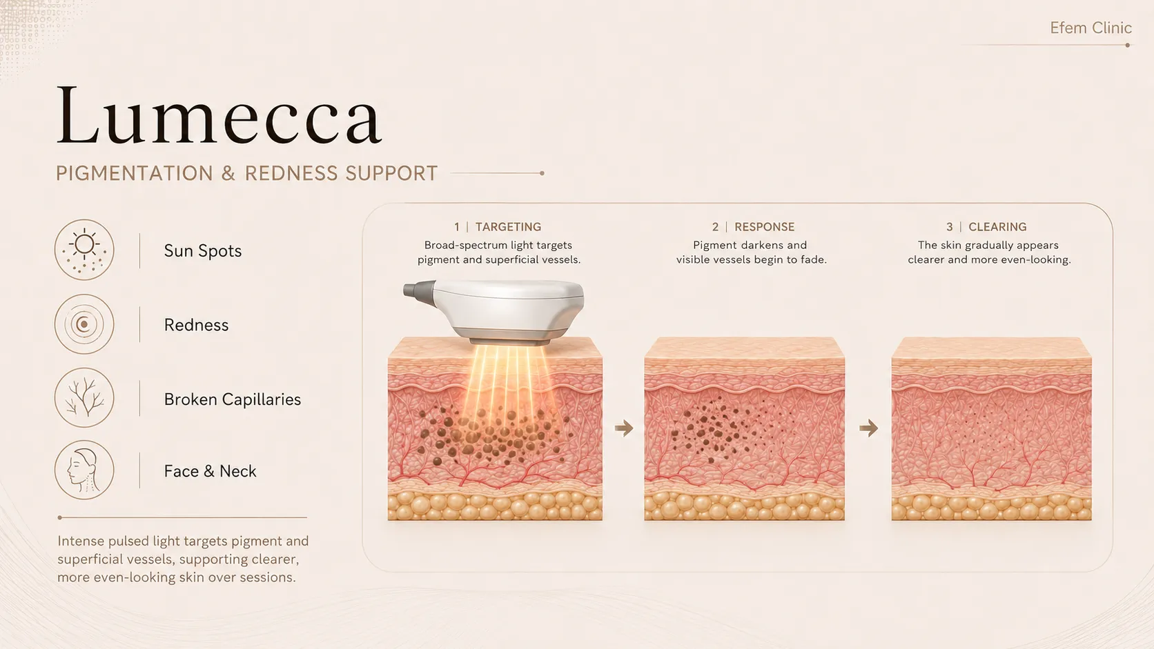 how lumecca works