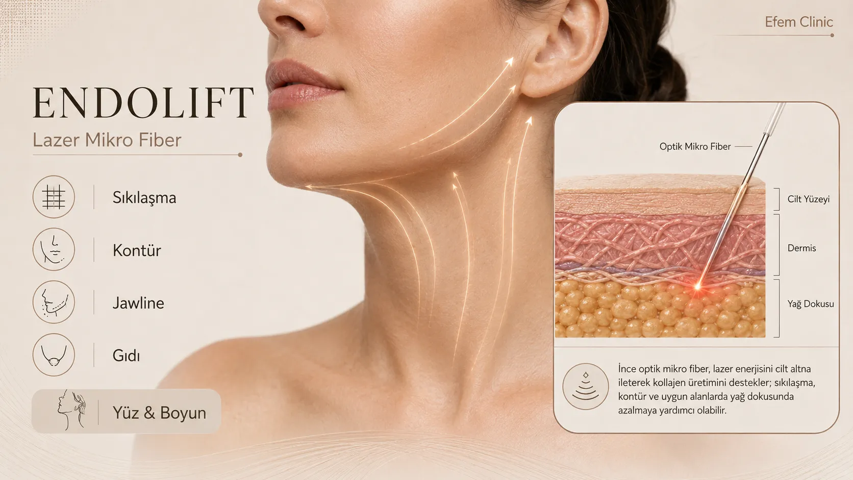 endolift-nedir-nasil-calisir