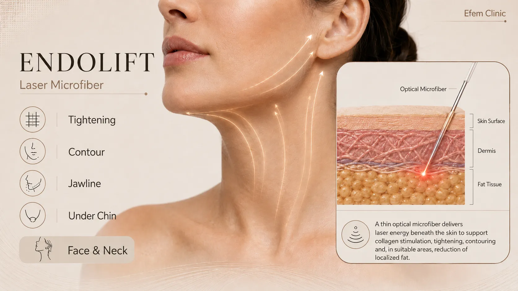 endolift-treatment-how-it-works
