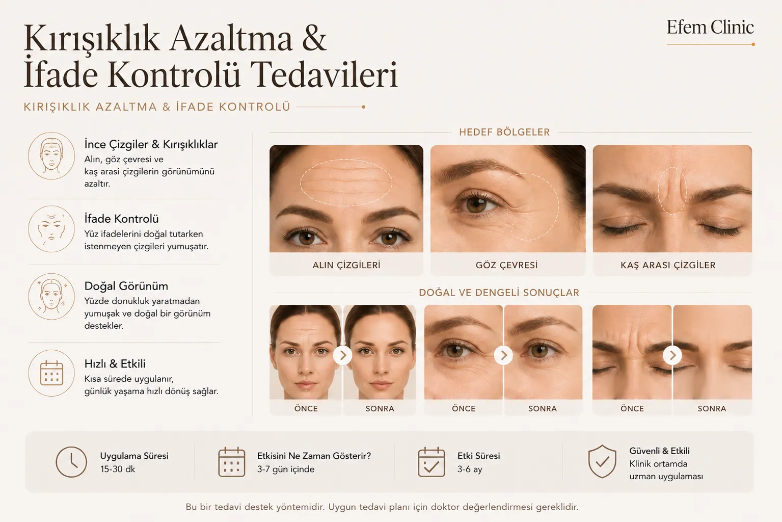 kırışıklık karşıtı tedaviler