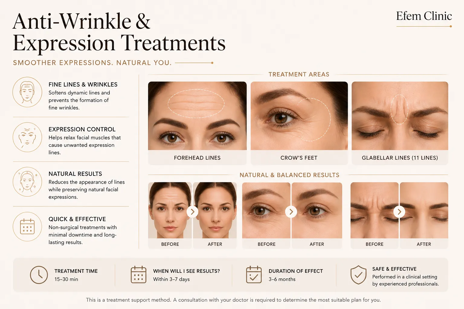what is anti wrinkle treatment