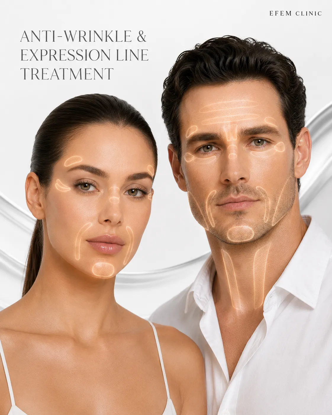 anti wrinkle and expression treatment areas