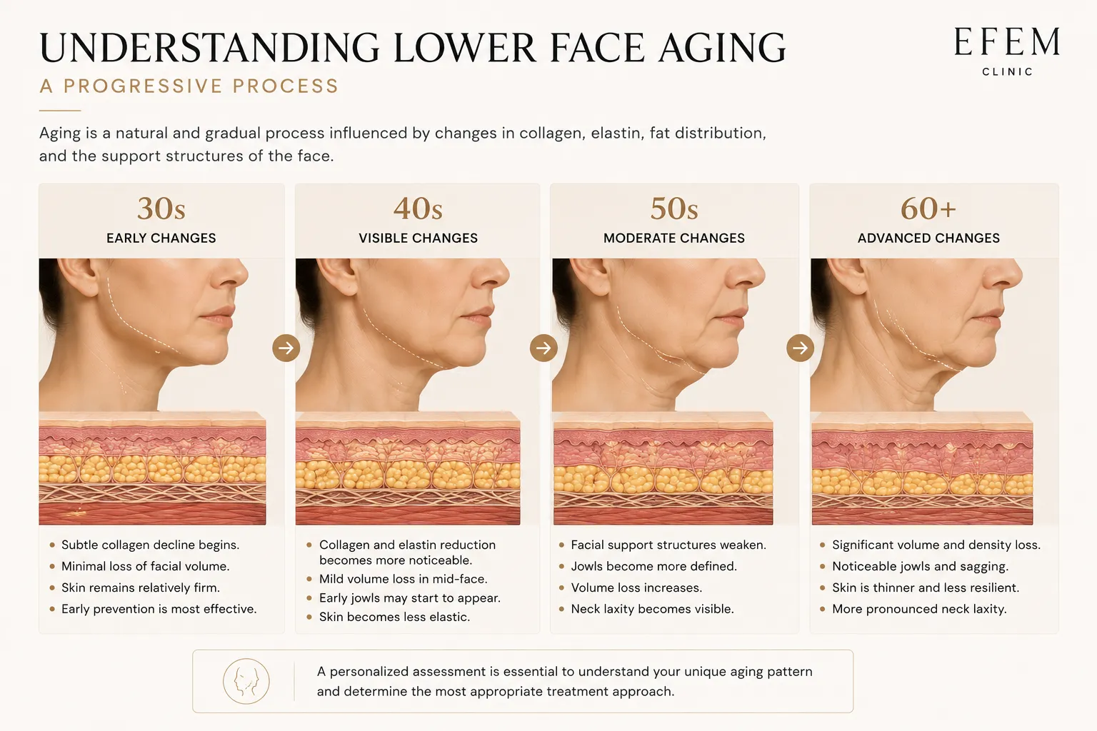 Understanding lower face aging and changes over time