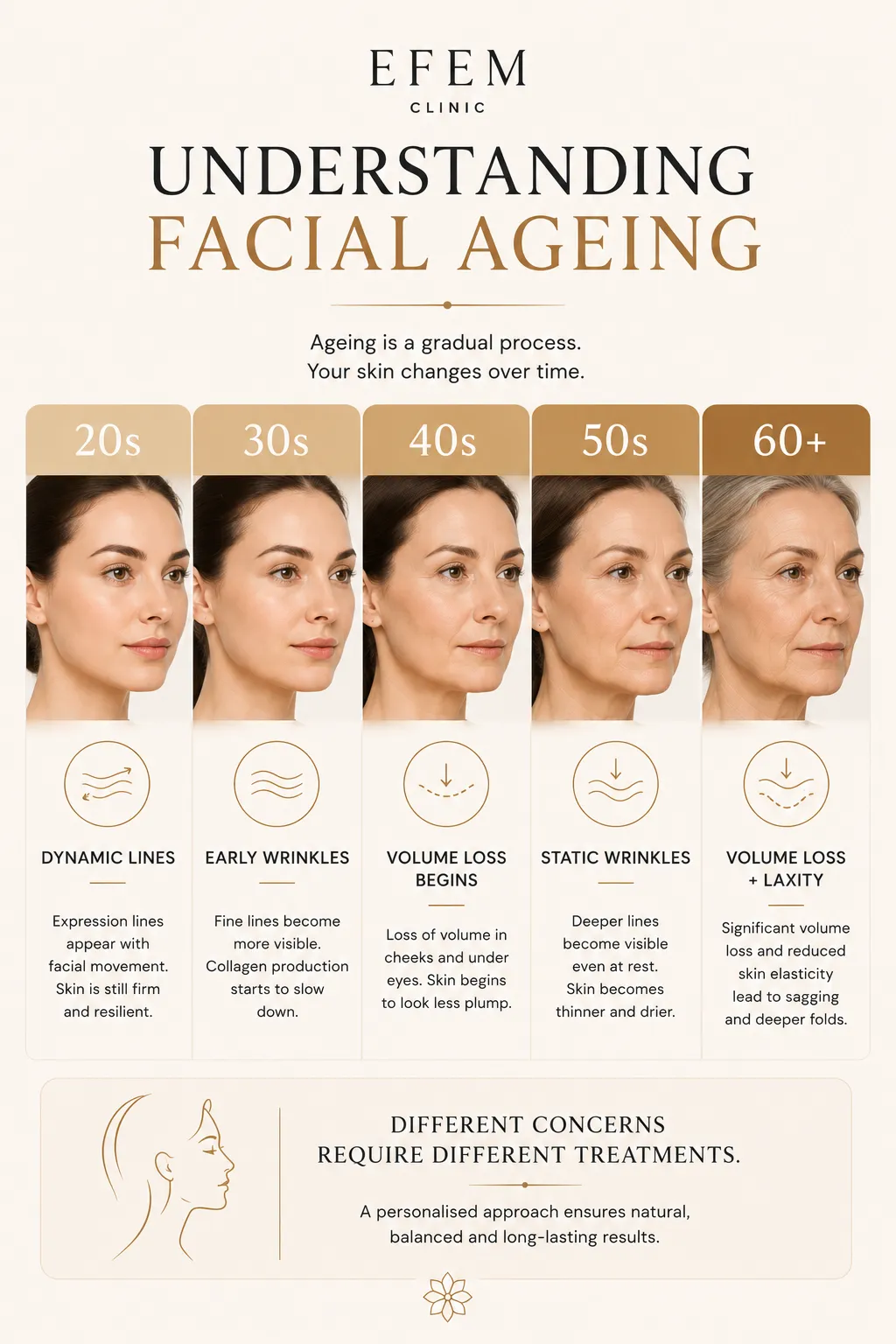 Understanding facial aging movement wrinkles volume loss skin laxity and facial support
