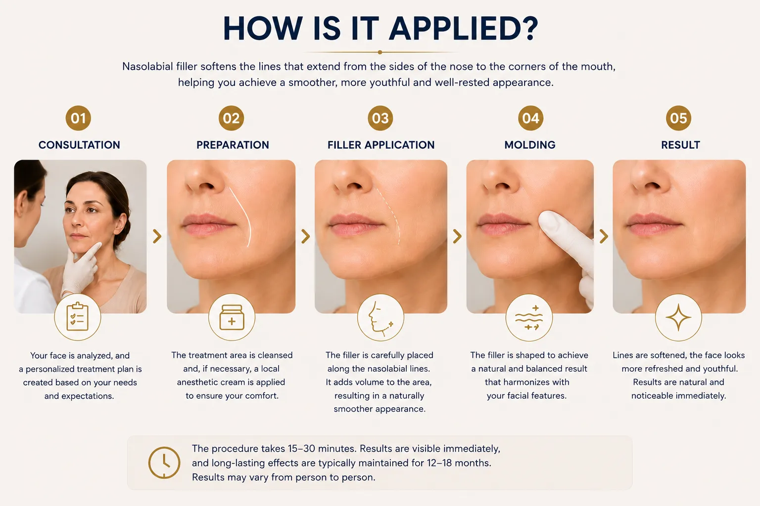 How nasolabial filler works with facial analysis volume loss and natural filler planning Istanbul