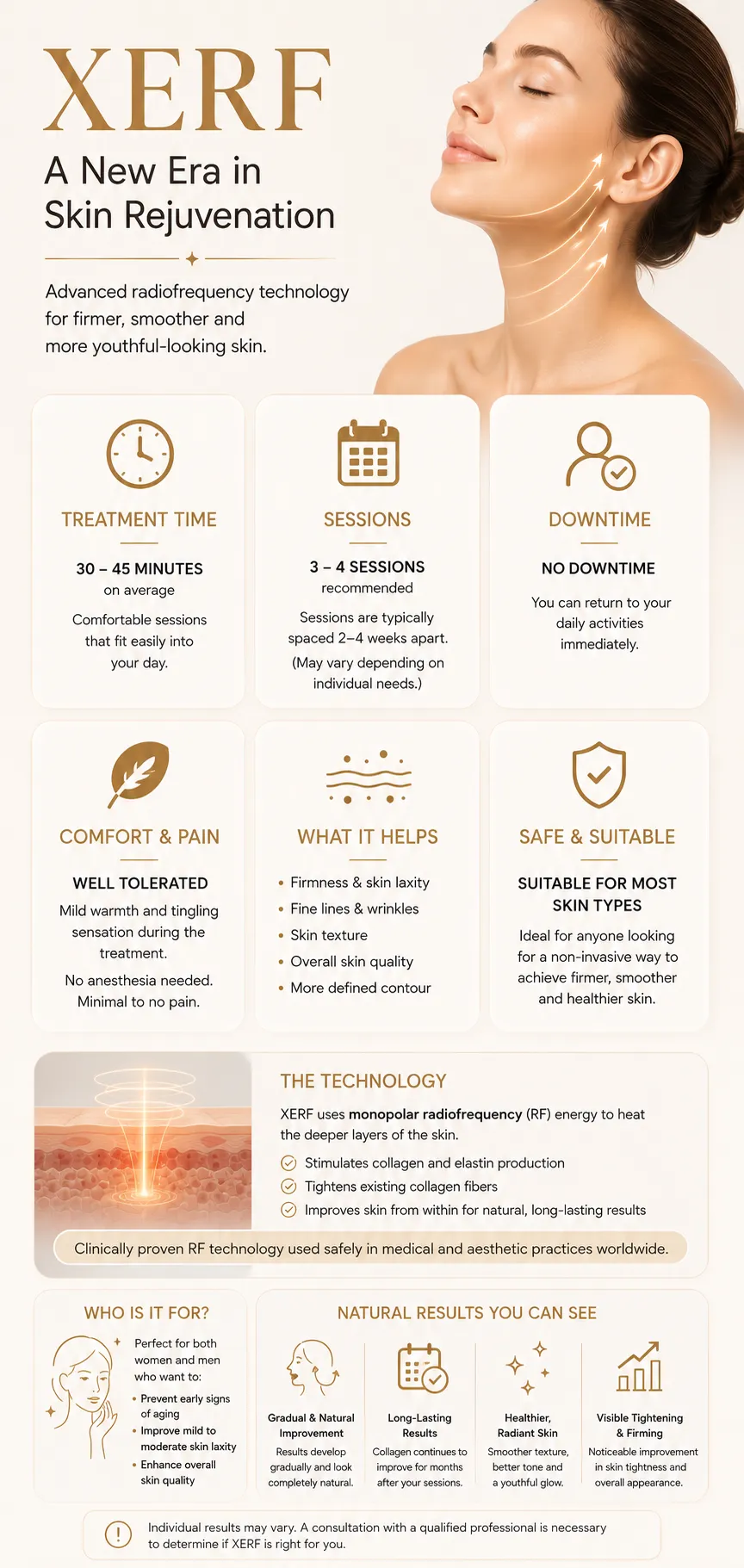 XERF RF Istanbul infographic showing treatment time comfort downtime sessions and results