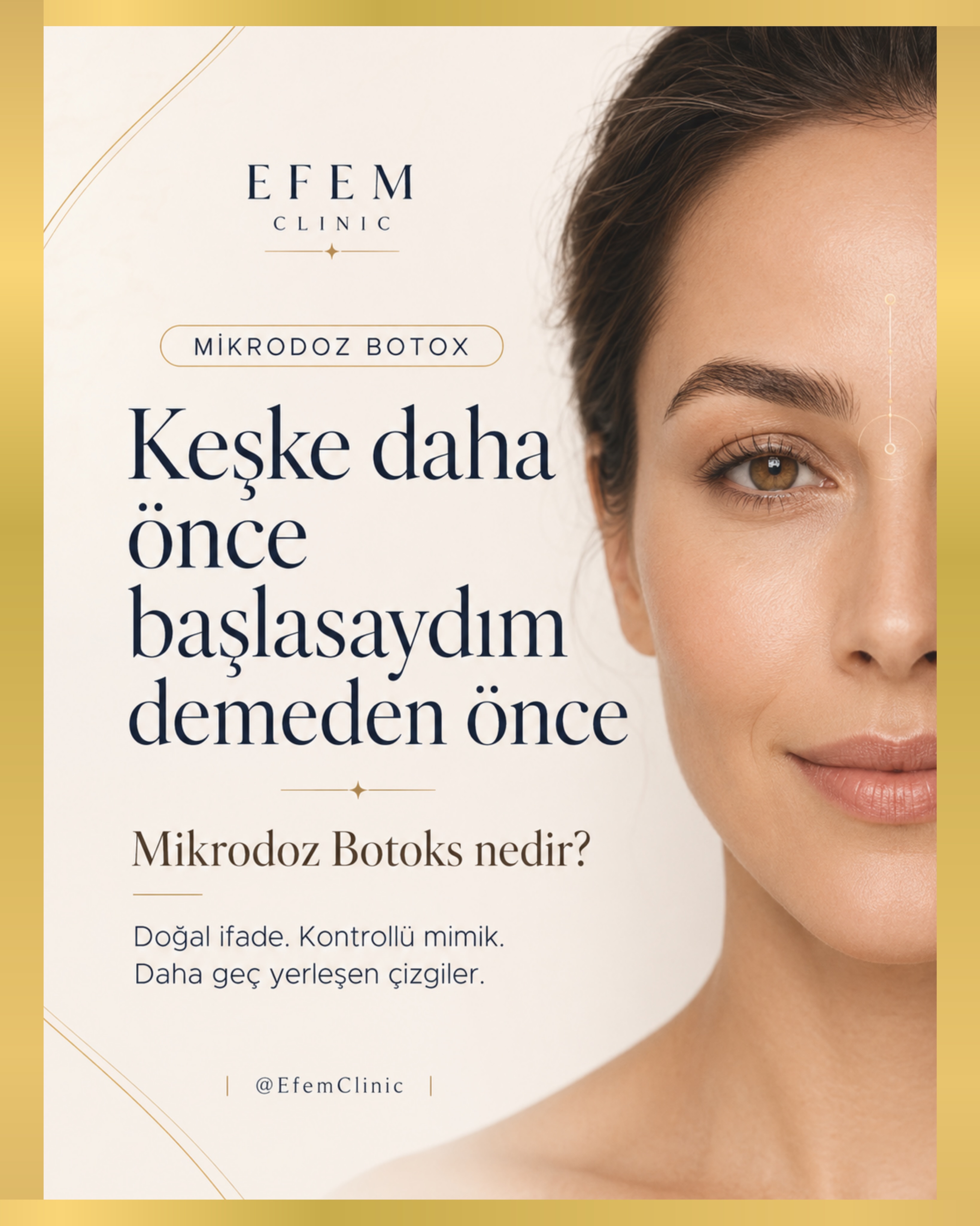 Botoks denildiğinde birçok kişinin aklına donuk ifadeler geliyor. Oysa modern yaklaşım, mimikleri tamamen durdurmak değil; on